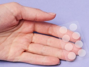 Can Patches Heal Your Acne?