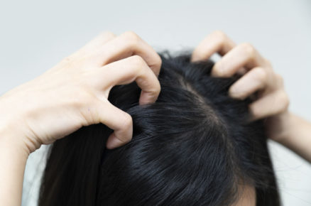 How to Deal with an Itchy Scalp