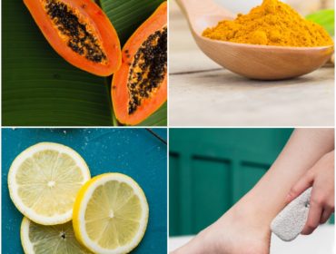 Natural Remedies for Hair Removal