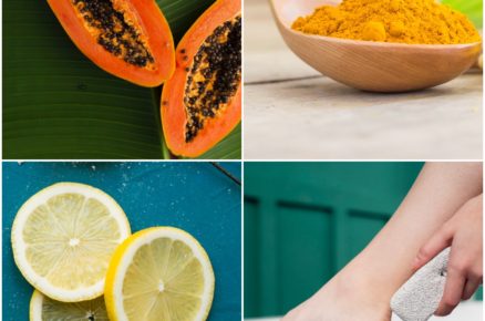 Natural Remedies for Hair Removal