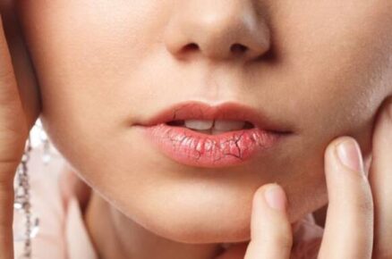 Tired of Dry Lips & Cheeks? Try These Tips