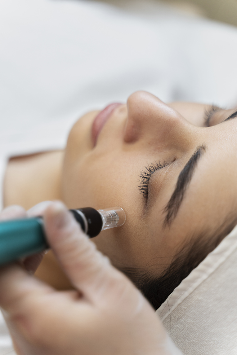 The Truth About Microneedling Myths vs. Reality-Cover Image